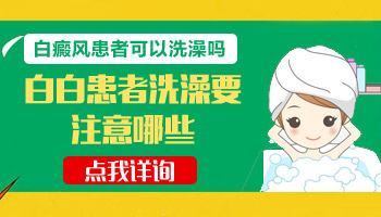 后背白癜风做了308几个小时不能洗澡