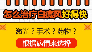 背上的白癜风怎么治 都有哪些治疗方法