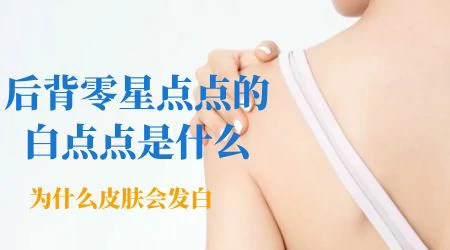 孩子从小后背就有白斑是怎么回事