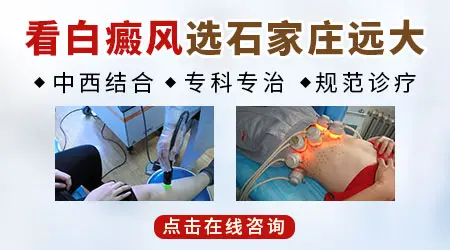 后背白癜风初期症状表现图