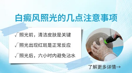 后背白癜风照射家庭版光疗机行不行