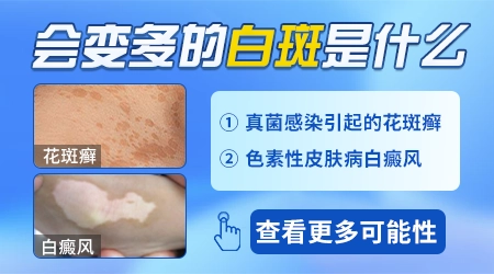 后背上出现白色的斑数量变多会是什么