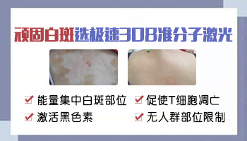 腰腹部发展期白癜风怎么治疗好