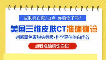 颈部和脸上有白点做皮肤ct能确诊是不是白癜风吗