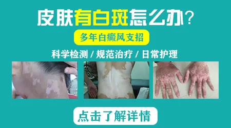 脖子后面一块白如何分辨是什么