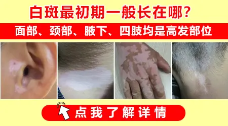 脖子处有块皮肤变白发亮是什么原因