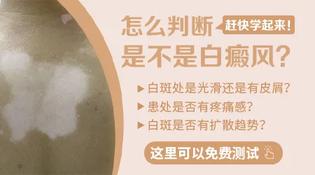 脖子侧面长白斑有可能是白癜风吗