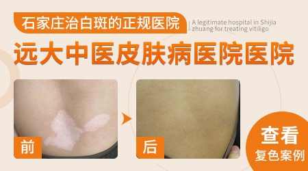 后脖子上有一块很白的皮肤是怎么回事