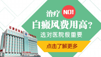 脸部白癜风光疗一次多少钱