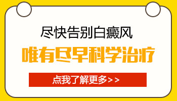 女性脸部左下角长白斑怎么治疗