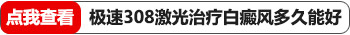 脸部白癜风照308激光怎样看出有好转