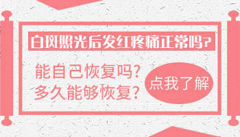 白癜风照了308激光后脸痒刺痛怎么办