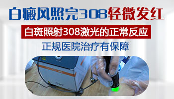 脸部308初期照光几秒可以红