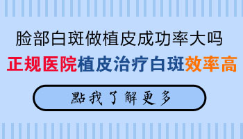 白癜风眼皮可以做植皮手术吗