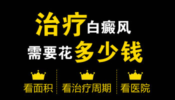 治疗男性脸部白癜风费用大概多少