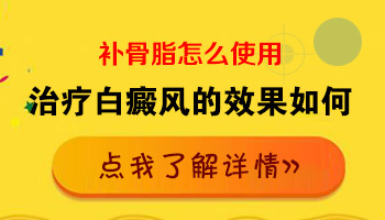 嘴角白斑抹补骨脂不太管用