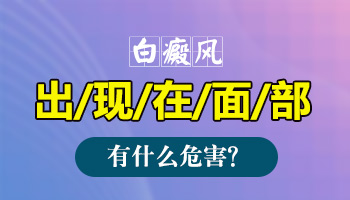 治疗面部白癜风安全有效的方法有哪些