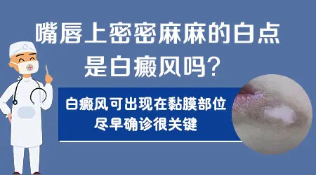 嘴角边上有块皮肤发白是白癜风吗