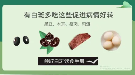 治疗脸部白癜风必须照光吗