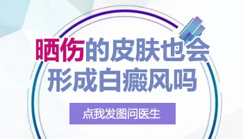 孩子晒后脸上长白斑