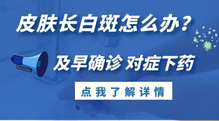 脸上有一块皮肤发白是怎么回事