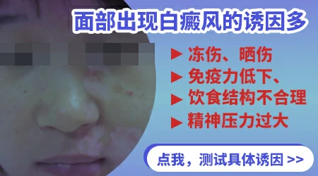 面部长了几个小白斑怎么回事