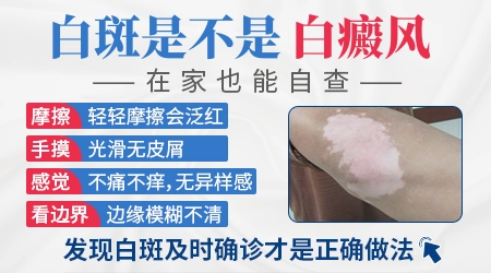 脸上有一块白斑图片