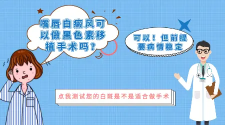 面部白癜风能做手术吗 会不会留疤