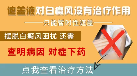 面部白癜风能不能用遮盖液