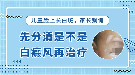 二十岁女孩脸上白一块怎么回事