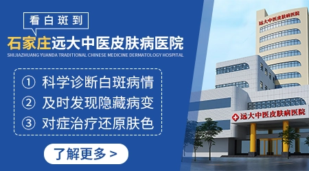 脸上突然长了一小块淡白斑怎么回事