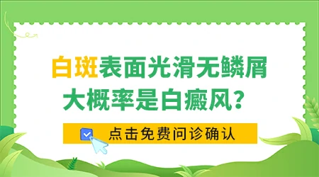 脸上一小块白斑表面光滑不痒是早期白癜风吗