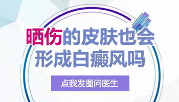 手臂晒伤出现白点是不是白癜风