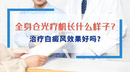 全身都出现了白癜风还有必要治疗吗