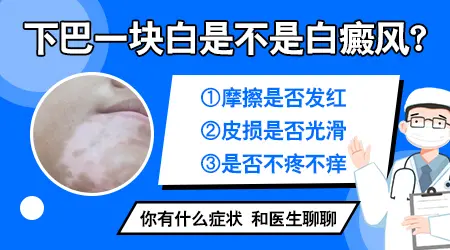 下巴有块白斑是怎回事