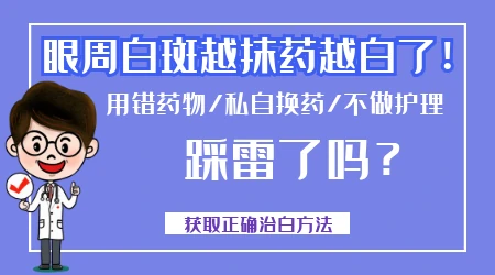 眼角有白斑抹药多久见效