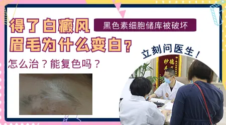 眉毛上方有皮肤变白是怎么了