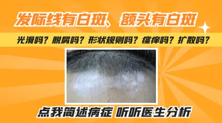 发际线边缘变白一块是怎么回事
