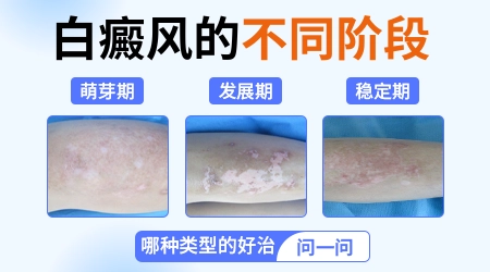 上肢出现小圆浅色斑点是什么病