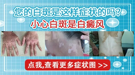 肛门周围有白色斑是怎么回事