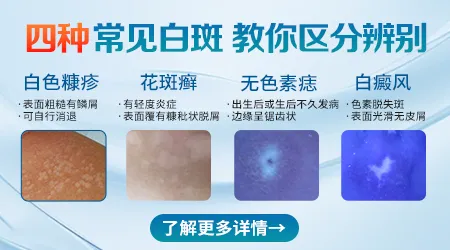 额头长白斑是什么原因造成的