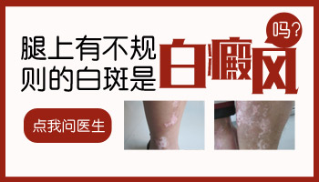 大腿根部淡白色的斑点是什么