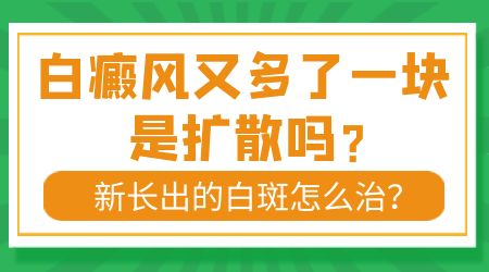 腿上的白癜风又增加了好多怎么治疗