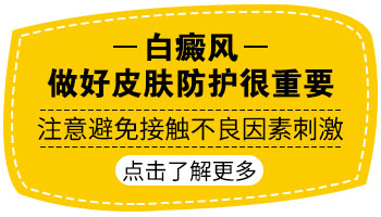 腿上的白癜风又增加了好多怎么治疗