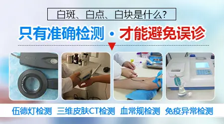 大腿上有个小白点图