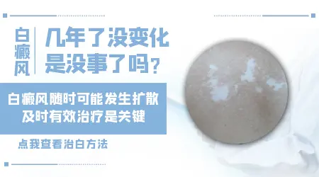 大腿外侧白斑好几年了没变化