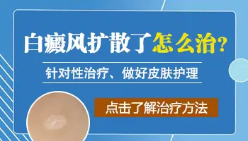 小腿外侧白癜风蔓延成一大片了