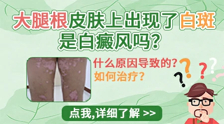 腿上有很多小白斑不疼不痒是什么
