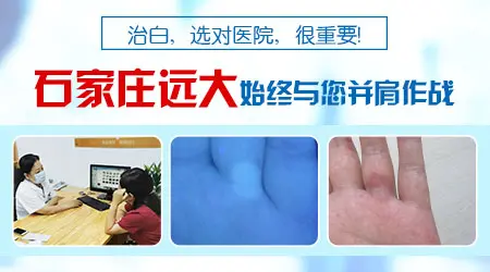 大腿起白色点怎么回事 能不能自愈