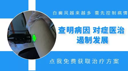 腿上出白点越来越多怎么回事